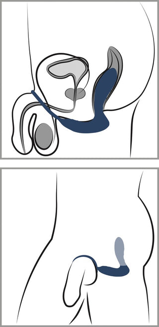 Analvibrator "Vibrating Prostate Plug with Cockring" – Für perfekte Performance und intensive Orgasmen