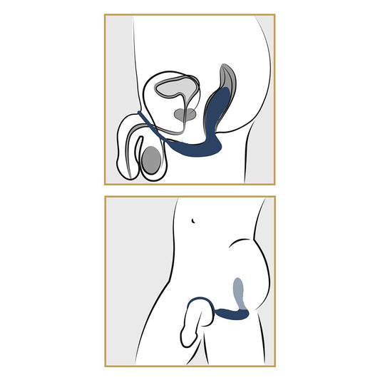 Vibrierender Prostata Plug mit Penisring Anwendung